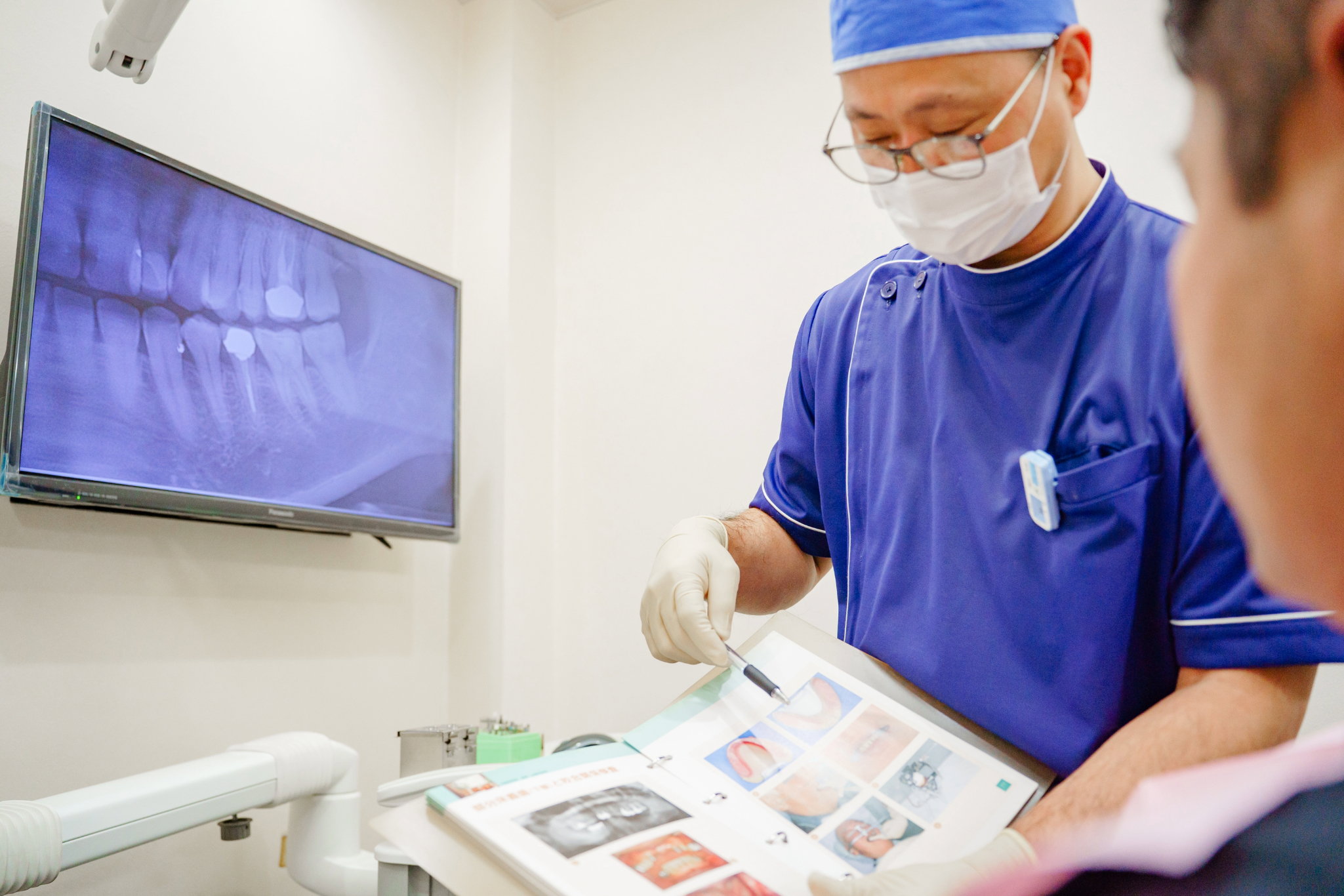 コンフォートデンチャー（歯数による）