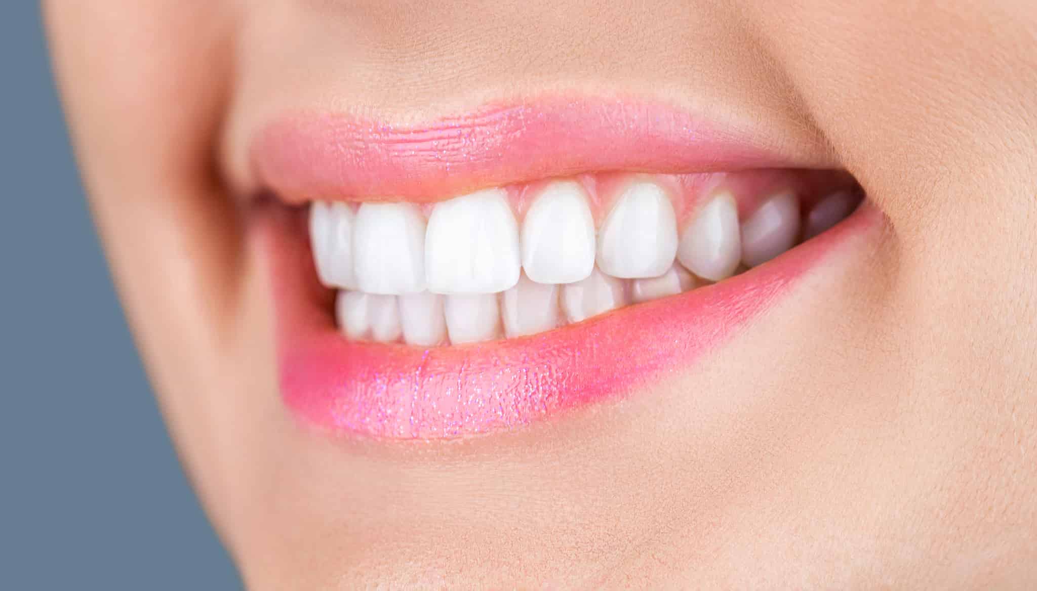 ホワイトニング