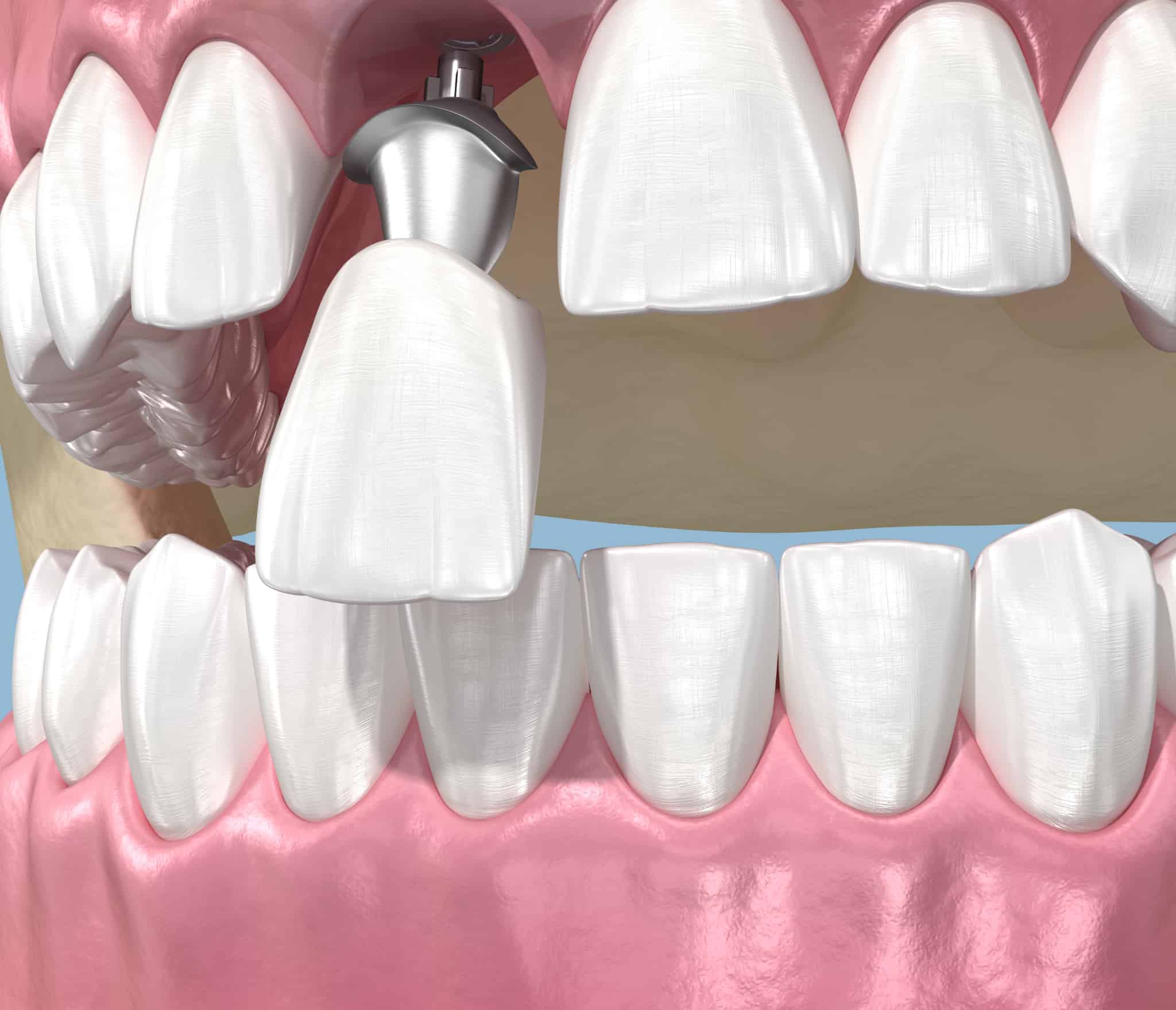 外科手術が必要